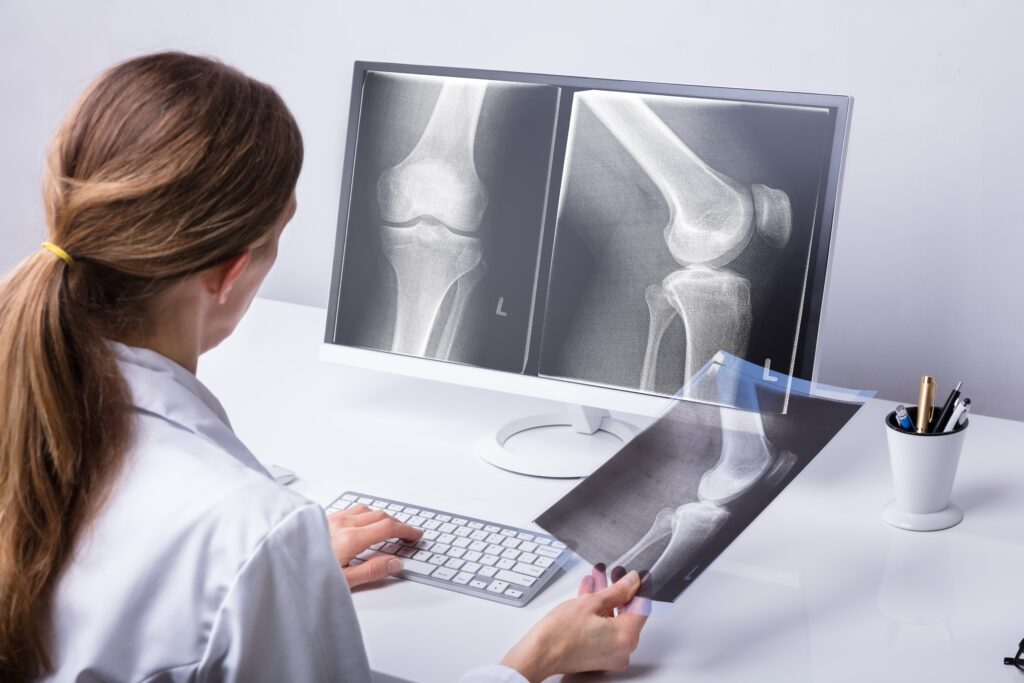 Doctor examining a patient’s x-rays to diagnose their knee pain and begin treatment